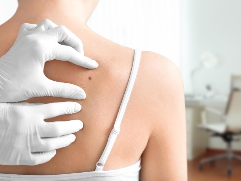 Kožní ambulance - MUDr. Martin Raus