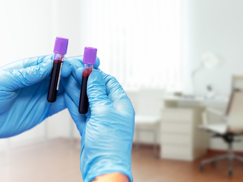 Odběrová místnost SPADIA LAB - Poliklinika SPADIA Hodonín